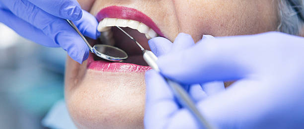Best Lost Filling or Crown Replacement in Covgton, IN